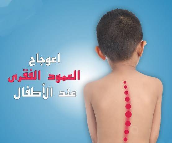 دكتور جراحة العمود الفقري أطفال الرياض